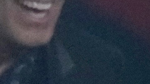 Billy Joel fue diagnosticado con una enfermedad cerebral.