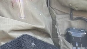 DHS acusa a un manifestante de arrancarle un dedo a un agente federal con un mordisco en Minnesota