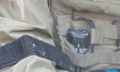 DHS acusa a un manifestante de arrancarle un dedo a un agente federal con un mordisco en Minnesota