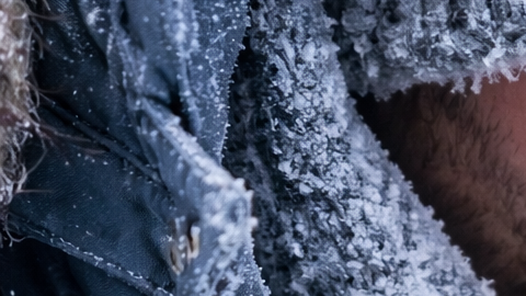 Persona con manos enrojecidas y entumecidas por frío extremo, señales de principio de congelamiento