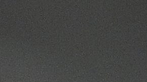 Francisco Lindor podría pasar por el quirófano por una lesión en el hueso ganchoso de su mano izquierda