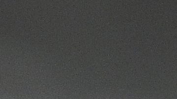 Francisco Lindor podría pasar por el quirófano por una lesión en el hueso ganchoso de su mano izquierda