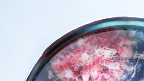 Formulario de prueba de enfermedades de transmisión sexual con muestra de laboratorio y preservativos sobre fondo clínico