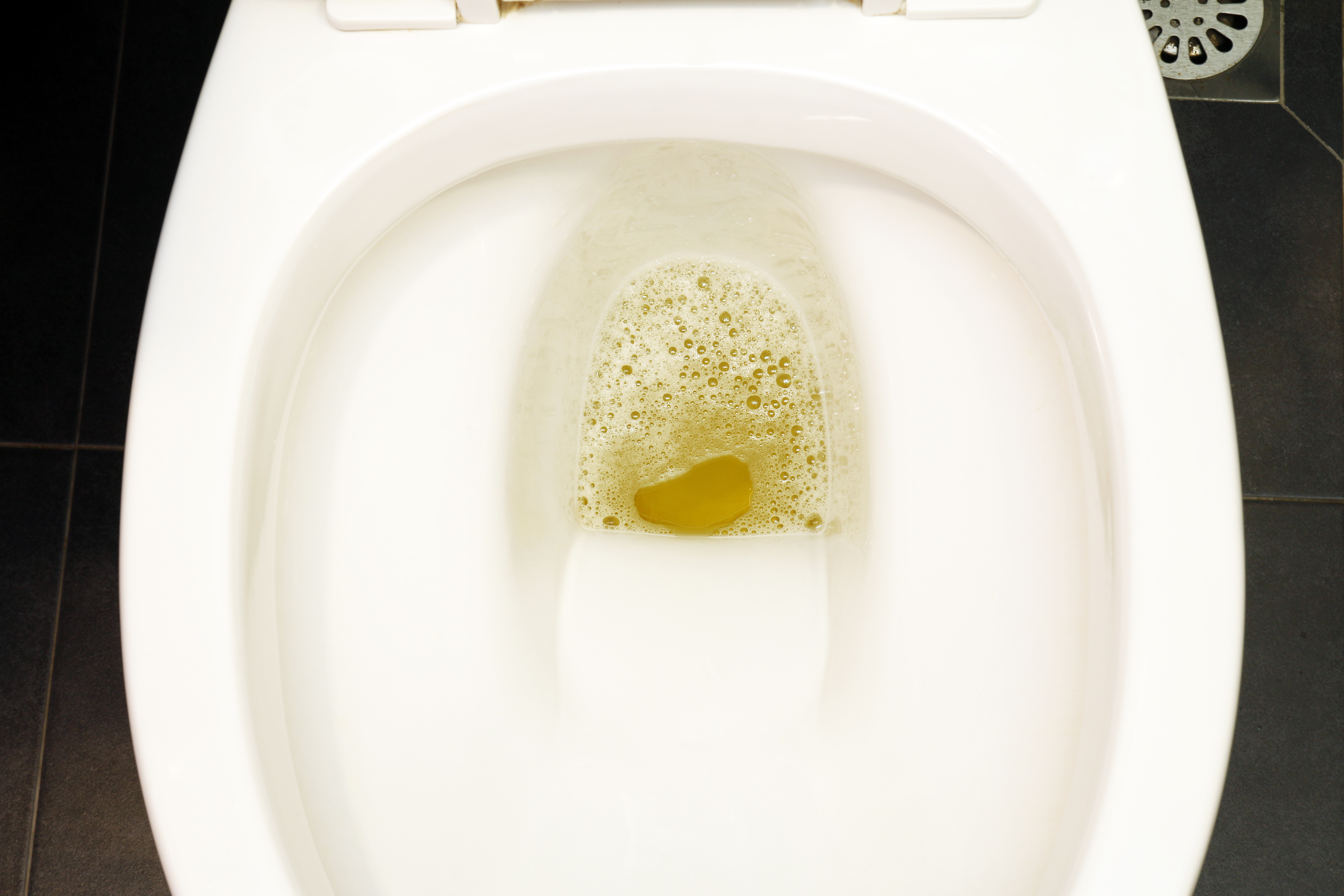 La orina espumosa o con burbujas persistentes puede indicar presencia de proteínas, una señal temprana de daño renal.