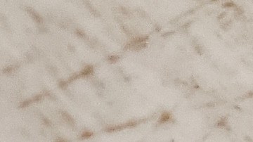 Es fundamental que aprendas a distinguir la orina espumosa que la espuma originada por la fuerza de la micción.