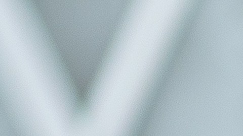 El dolor lumbar ya es una señal tardía, y es tan profundo que te envía directamente a urgencias médicas.