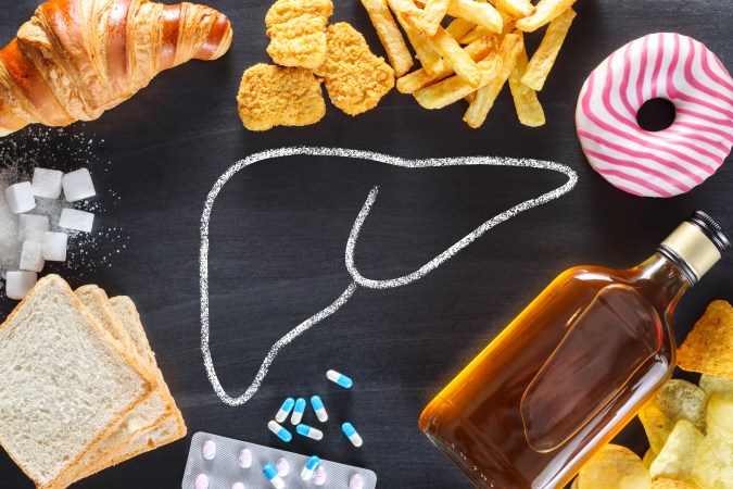 Composición fotográfica de alimentos altos en fructosa, sodio y grasas trans junto a una advertencia médica sobre el daño hepático y la cirrosis no alcohólica.