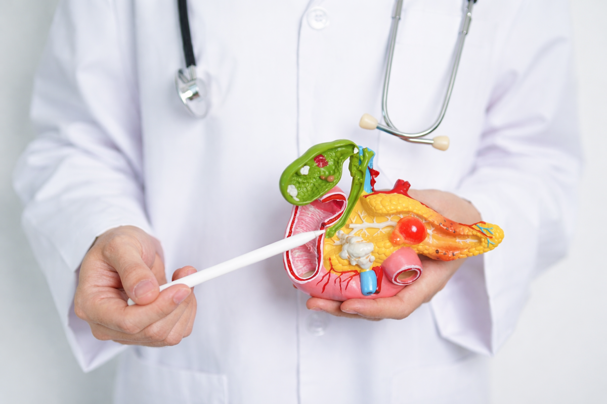 Cáncer de páncreas: las señales que muchos ignoran (y por qué suele detectarse tarde)