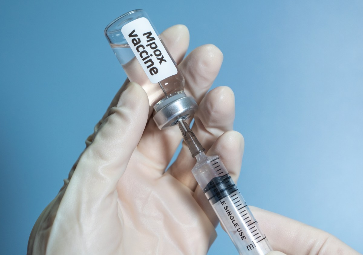 Detectan el primer caso de viruela del mono clado I en la ciudad de Nueva York