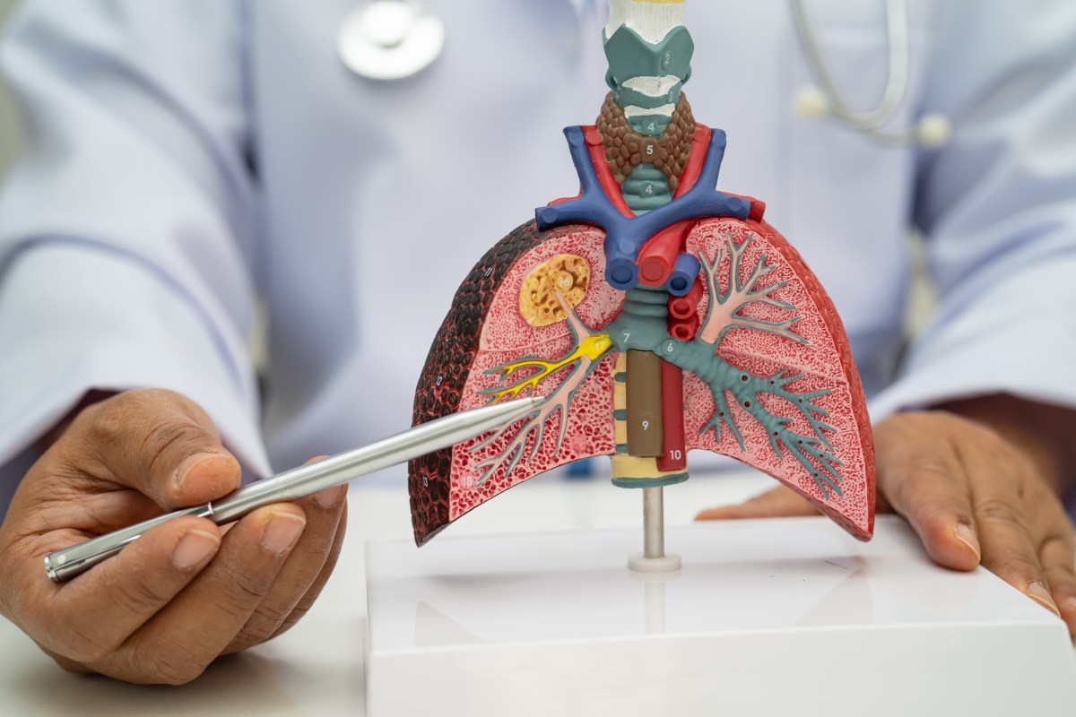 Líquido en los pulmones: 4 señales que debes atender de inmediato