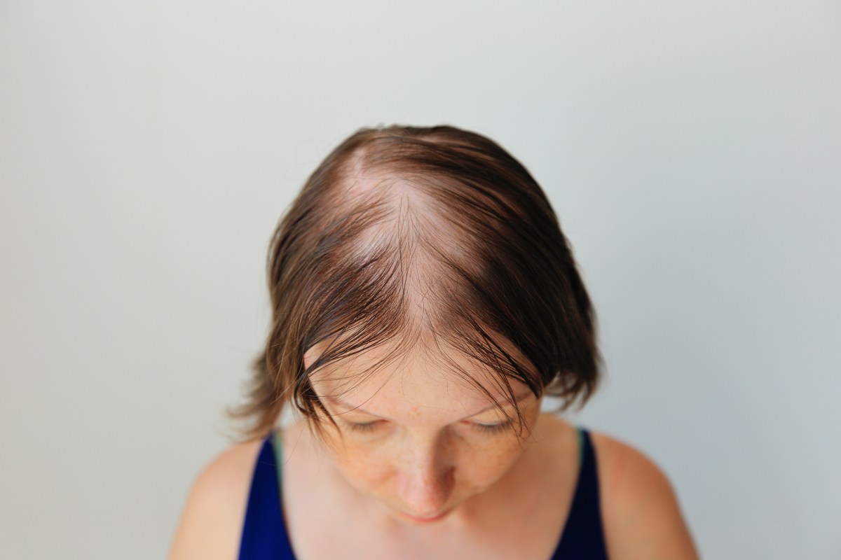 Recuperar el cabello en la menopausia sí es posible