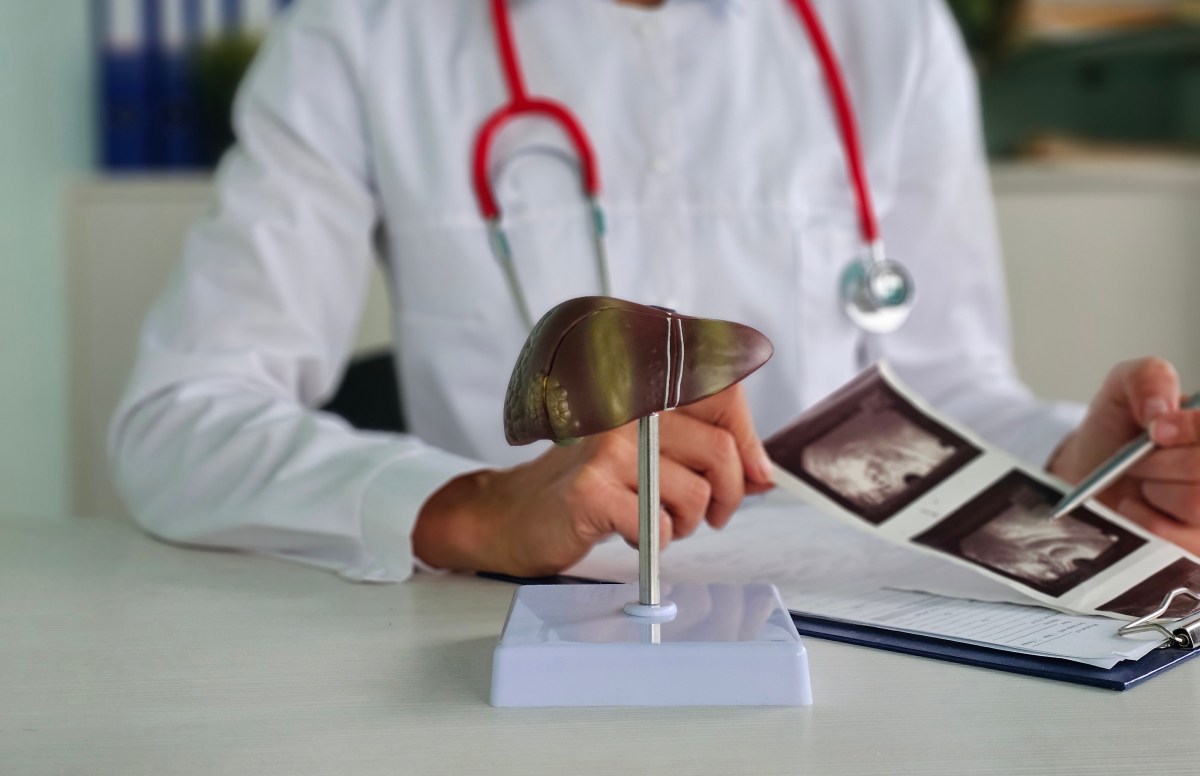 Este mal hábito daña tu hígado y los médicos no suelen comentarlo