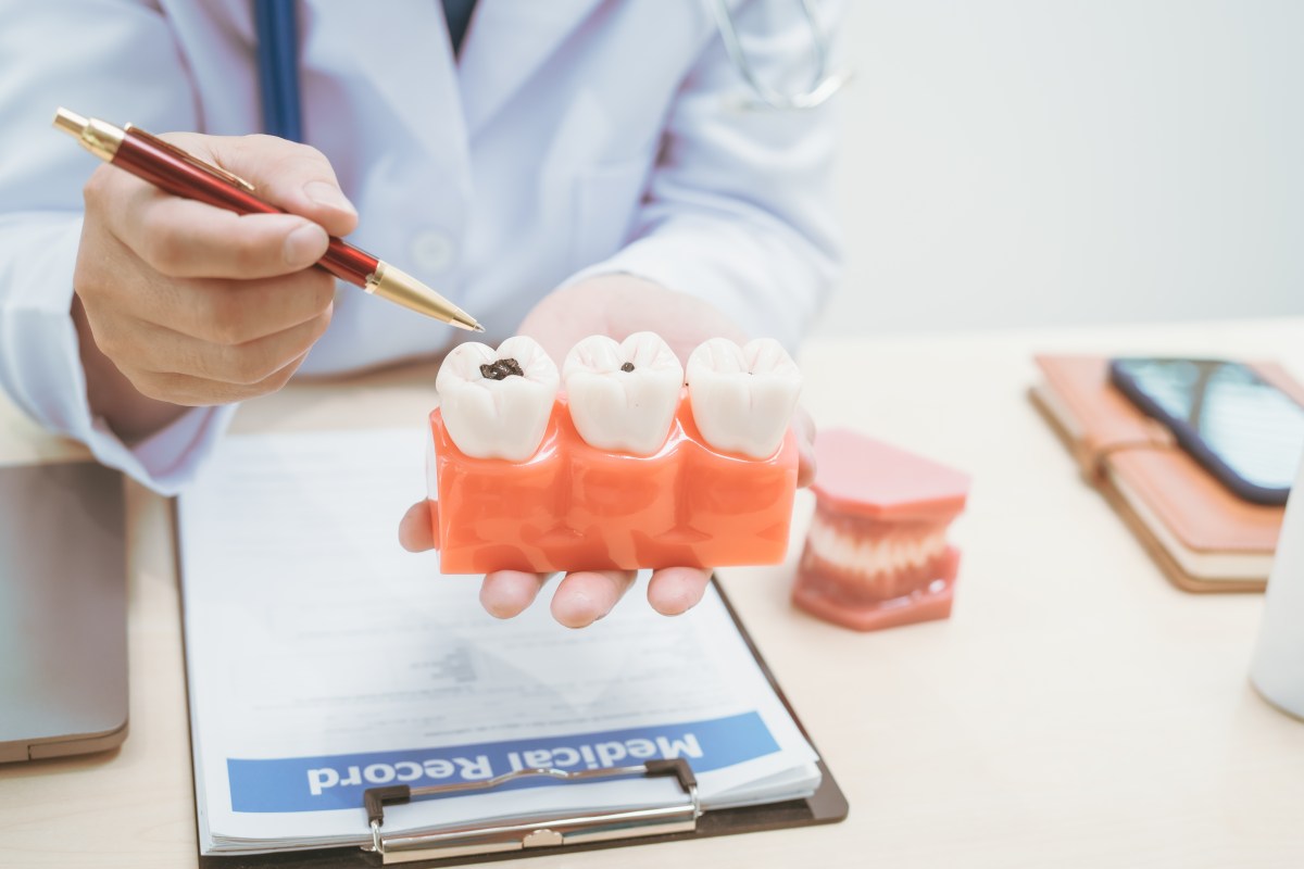 ¿Puedo morir por una infección dental? Médicos advierten