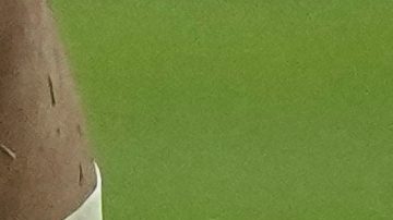 Kylian Mbappé, jugador del Real Madrid, yace en el césped tras lesionarse durante el partido de vuelta de los cuartos de final de la Liga de Campeones entre el Bayern de Múnich y el Real Madrid, disputado en Múnich, Alemania, el miércoles 15 de abril de 2026.