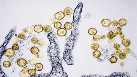 Hantavirus