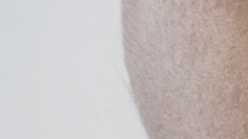 La infección vaginal por hongos produce picazón intensa, irritación, flujo blanquecino y mal olor.