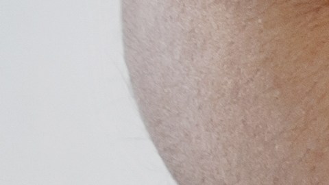 La infección vaginal por hongos produce picazón intensa, irritación, flujo blanquecino y mal olor.