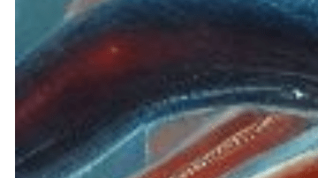 Causas de las enfermedades cardiovasculares.
