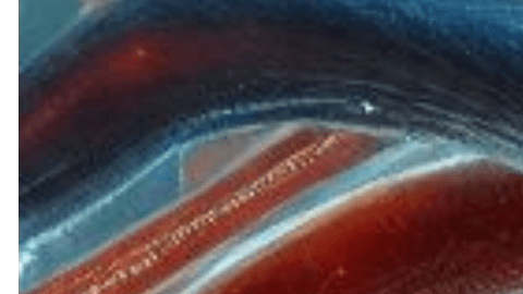 Causas de las enfermedades cardiovasculares.