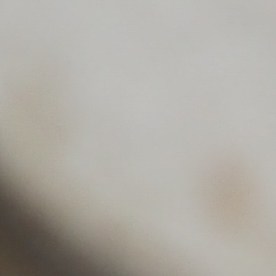 Algunos fármacos pueden elevar el nivel de azúcar en sangre o entorpecer los efectos naturales de la insulina.