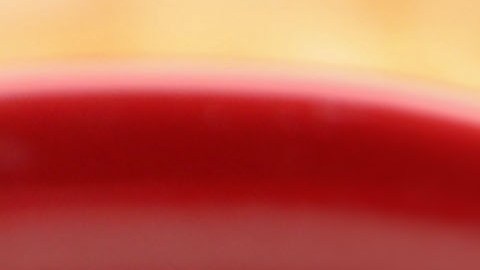 Las alternativas de proteína vegetal como la leche de soja se asocian con un menor riesgo de desarrollar enfermedad renal crónica.