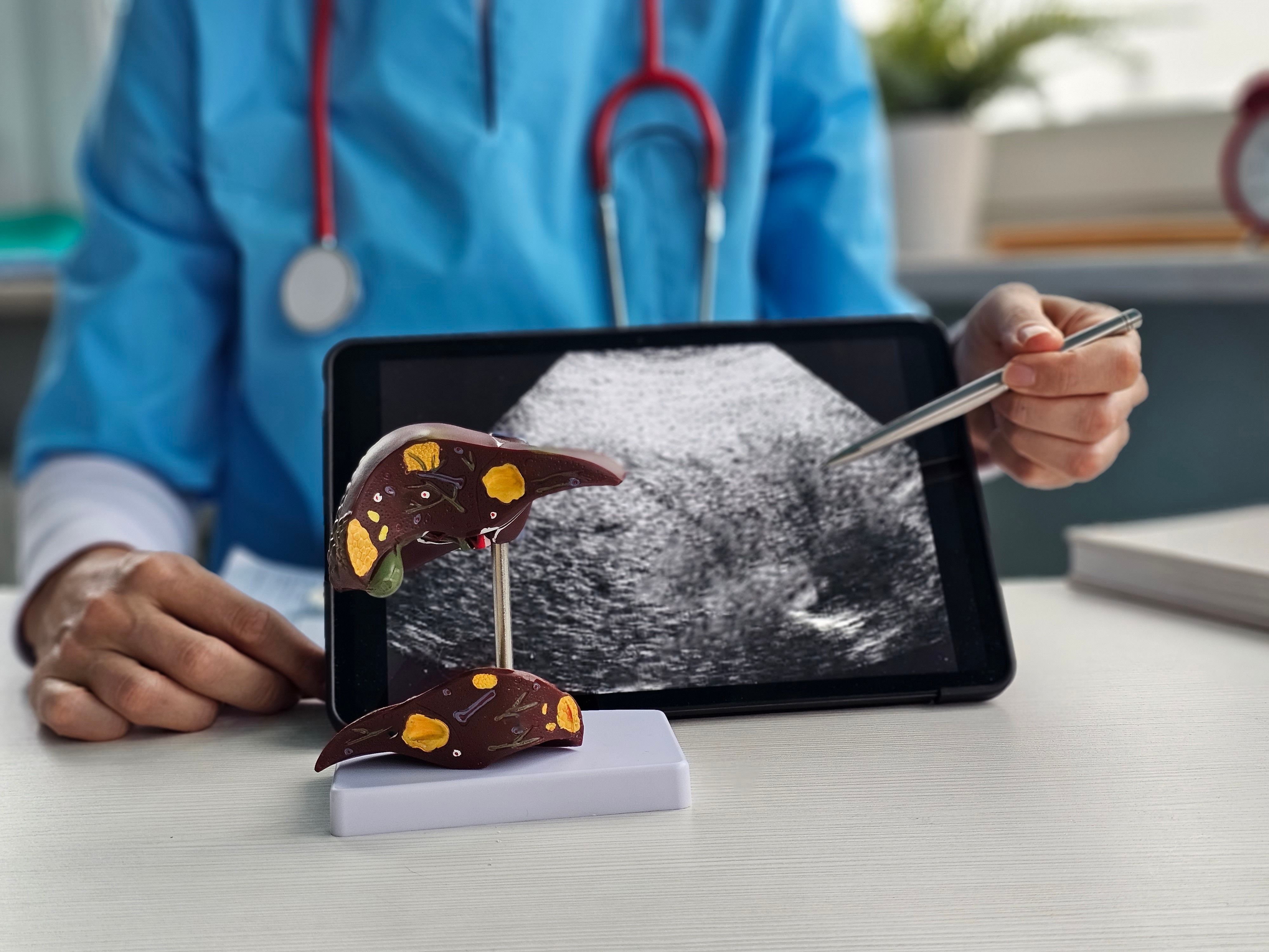 Cuántas veces al año debes chequear tu hígado y riñones con un médico