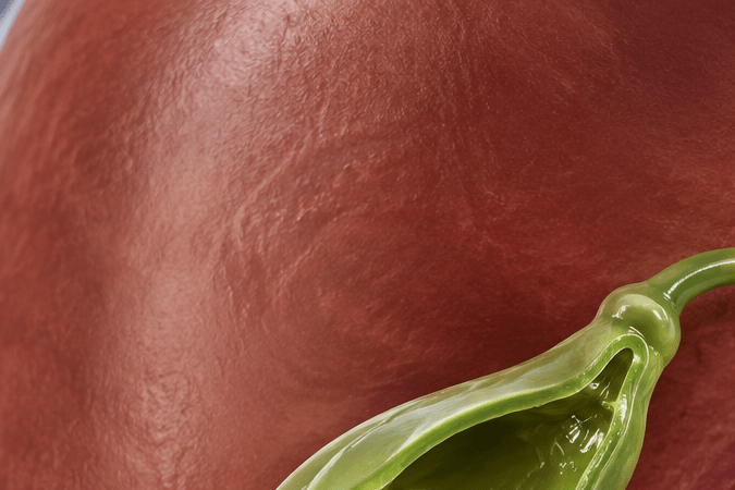 Piedras en la vesícula: por qué no siempre son inofensivas y cuándo requieren cirugía Mujer sentada en un sofá sujetándose el abdomen debido a un fuerte dolor abdominal, uno de los síntomas más comunes de las piedras en la vesícula.