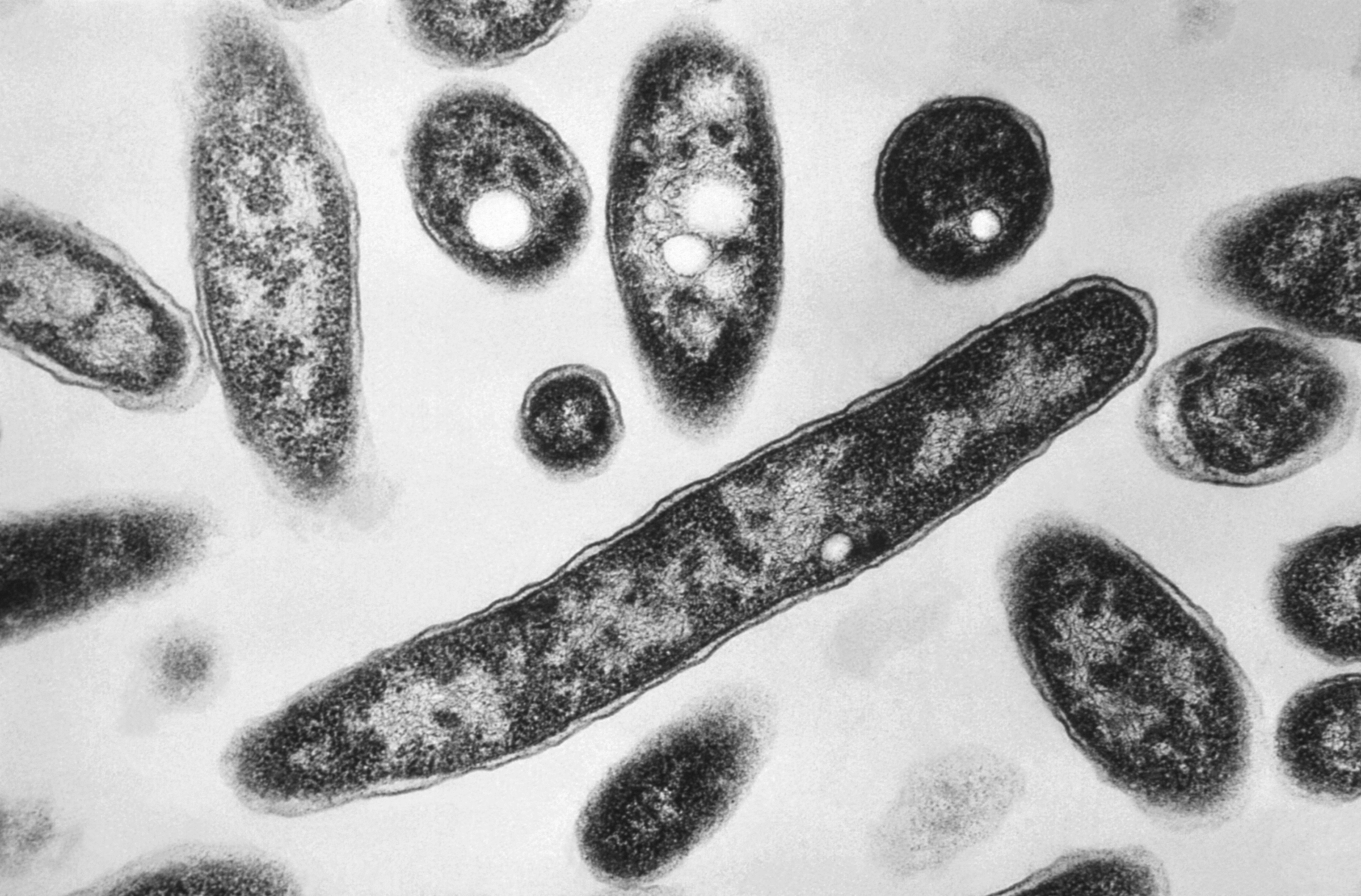 Aumentan a 11 los muertos por la epidemia de legionelosis en el Upper East Side