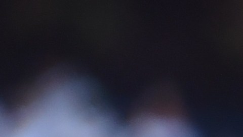 Jamal Musiala reveló que tiene una disfunción neurológica.