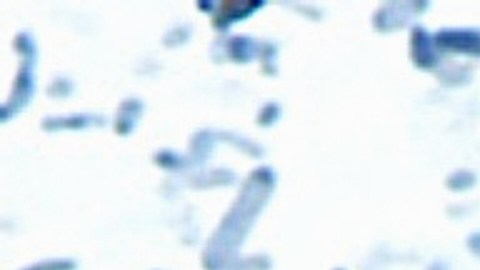 La Cyclospora es un parásito muy difícil de detectar.