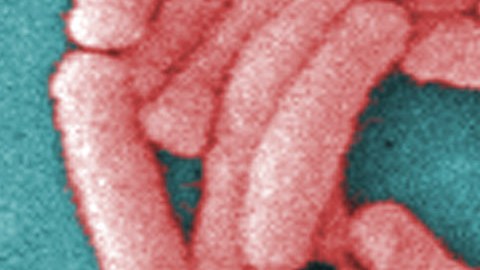 Los CDC muestran una gran agrupación de la bacteria Legionella pneumophila (enfermedad del legionario).