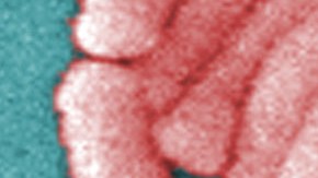 Los CDC muestran una gran agrupación de la bacteria Legionella pneumophila (enfermedad del legionario).
