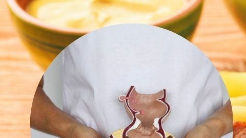 Evita el consumo de lácteos y grasas saturadas para prevenir la irritación de la mucosa intestinal durante los brotes